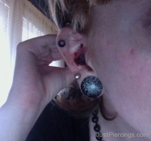 Lobe And Conch Stretching 23-JP1125