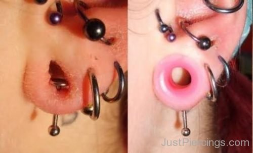 Lobe Stretching And Ear Ring Piercing-JP1081