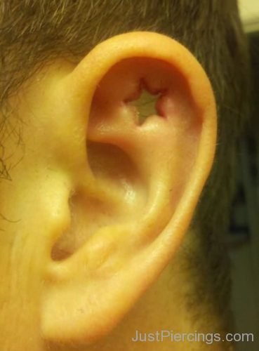 Star Dermal Punch Ear Piercing-JP1268