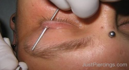 Eyelid Piercing With Long Needle-JP139