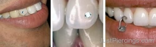 Gum Piercing 1-JP104
