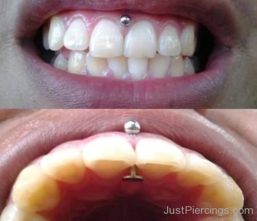 Gum Piercing With Silver Stud-JP111