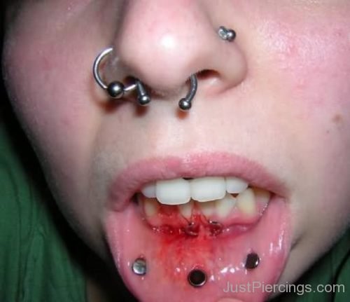Multiple Nose, Dermal Lips And Frowny Piercing-JP1100