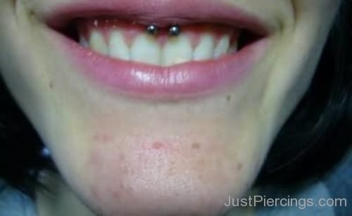 Smiley Gum Piercing-JP119
