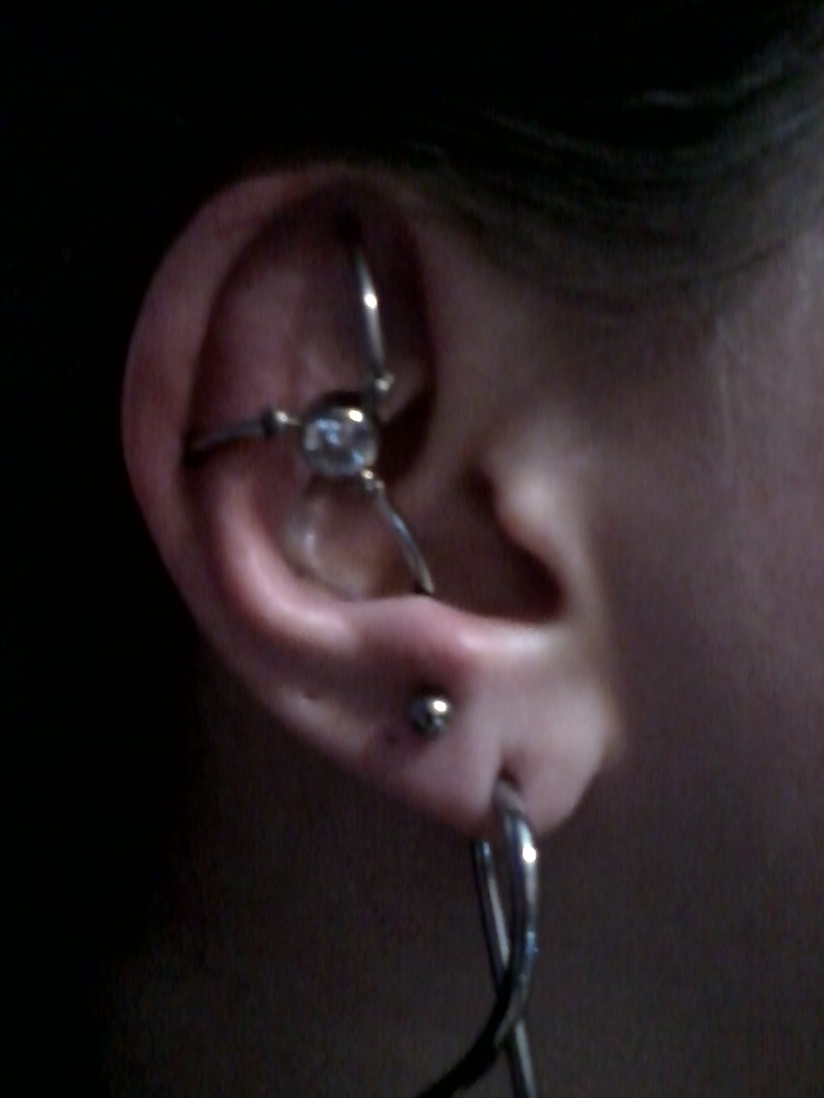 Double Cartilage and Anti Tragus