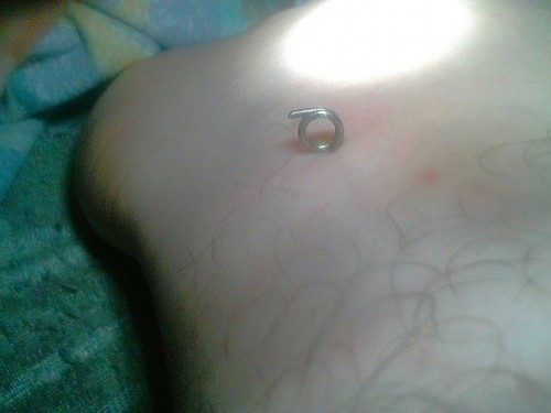 Pierced My Ankle